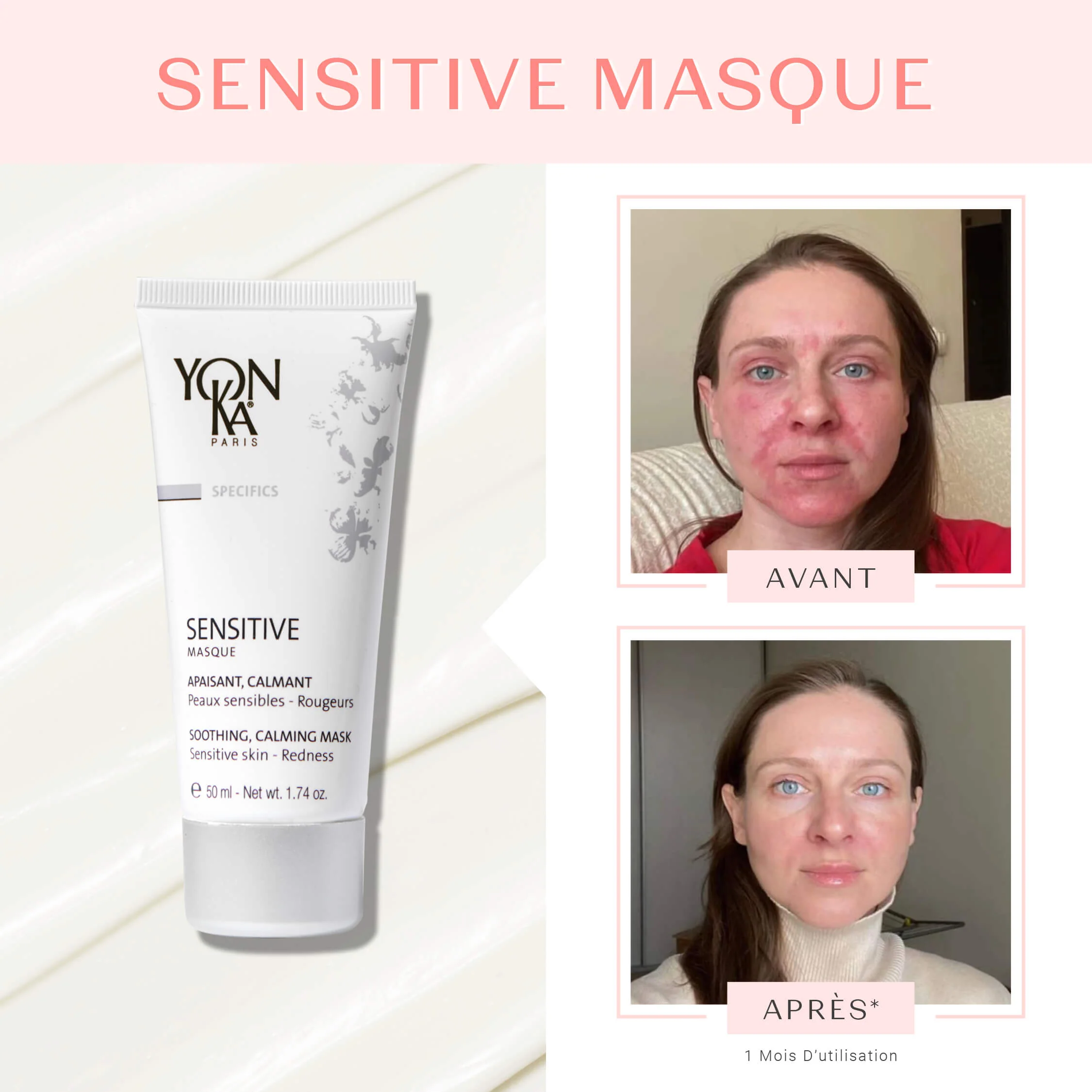 Sensitive Masque - Image 8